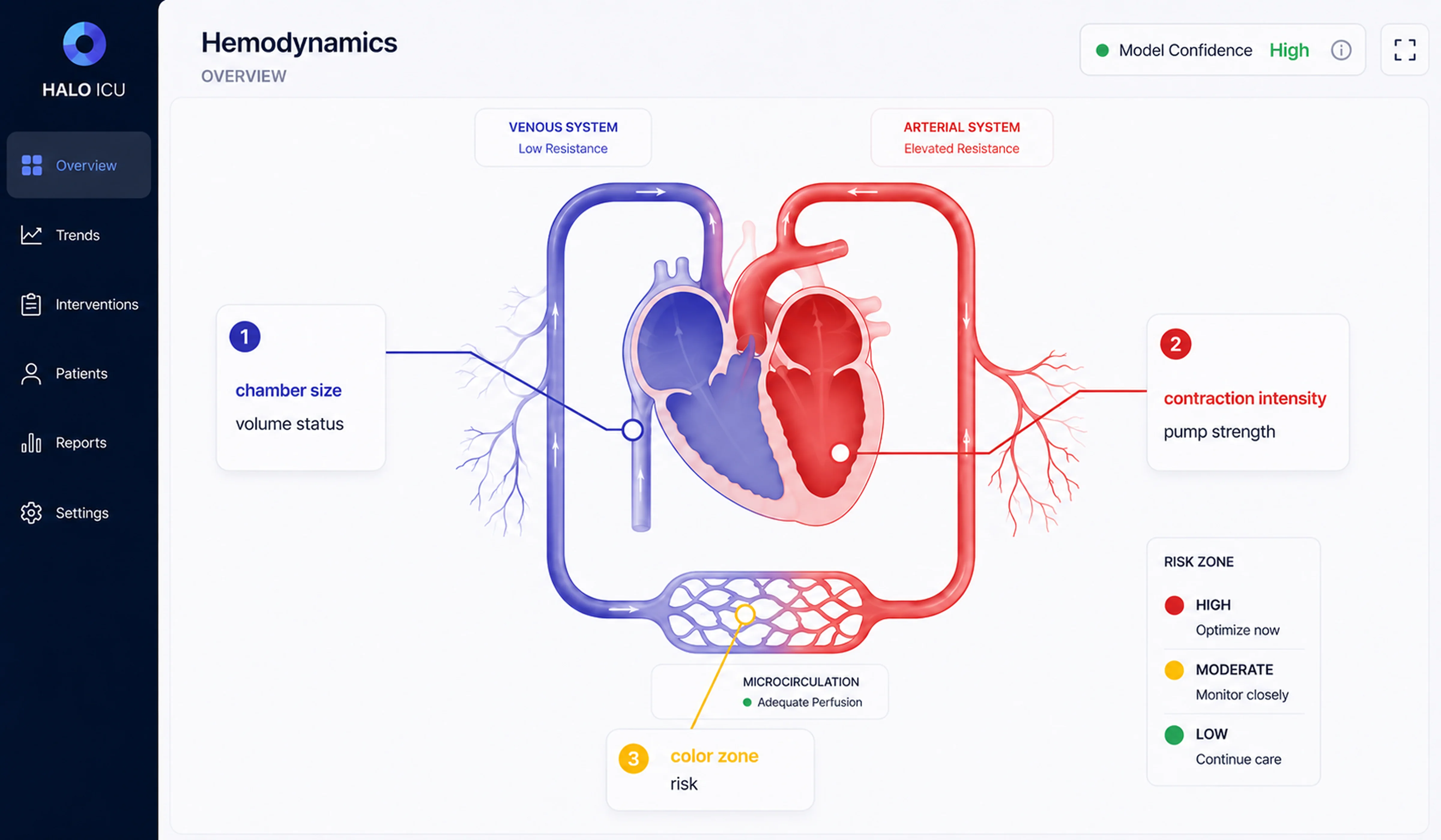 ICU interface: model data mapped to visuals for fast reading