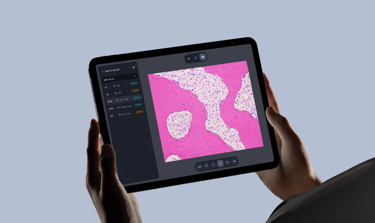 Building a scalable Laboratory Information System for modern diagnostics